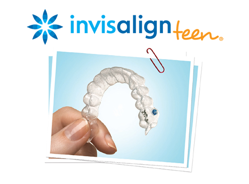 technology-invisalign-teen